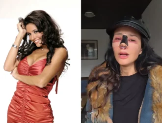 La Cirugía Estética en la Lupa: Dorismar Confirma Mala Práctica en Colombia y Busca Un Nuevo Rostro